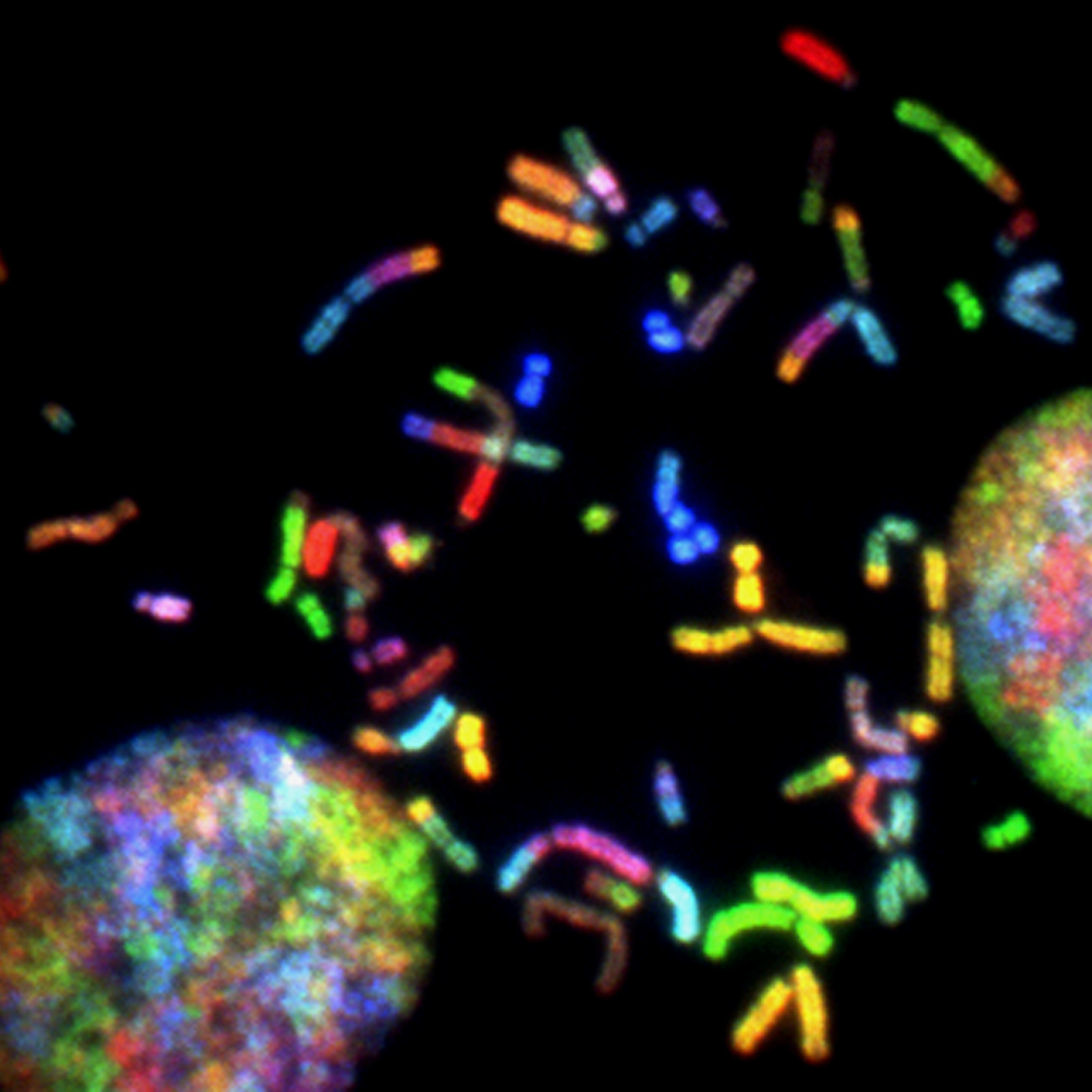 Brain Cancer Chromosomes. Chromosomes prepared from a malignant glioblastoma visualized by spectral karyotyping (SKY) reveal an enormous degree of chromosomal instability -- a hallmark of cancer